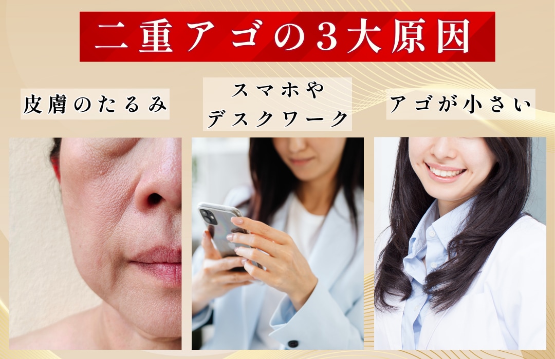 二重顎の原因は「たるみ」や「脂肪」！？